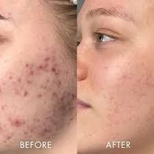 Boutique de cosmétiques naturels pour tous types de peau